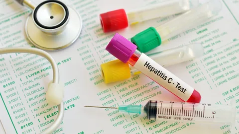 El 30 por ciento de los infectados logra eliminar el virus espontáneamente, sin tratamiento alguno