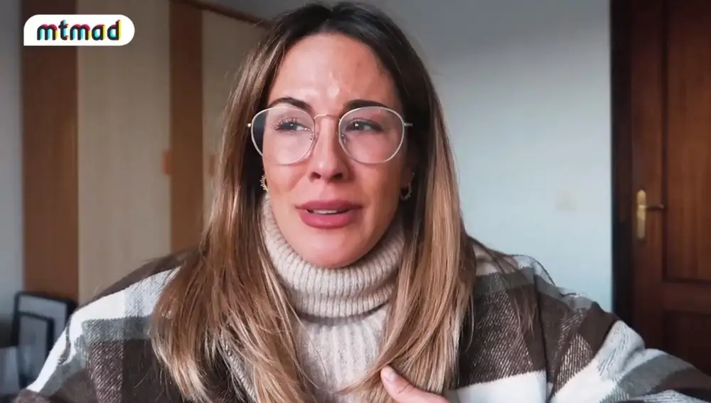 Susana se destroza la cara después del tratamiento