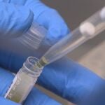 Aumenta la supervivencia a los cinco años de las personas con cáncer al 59% en hombres y 63% en mujeres