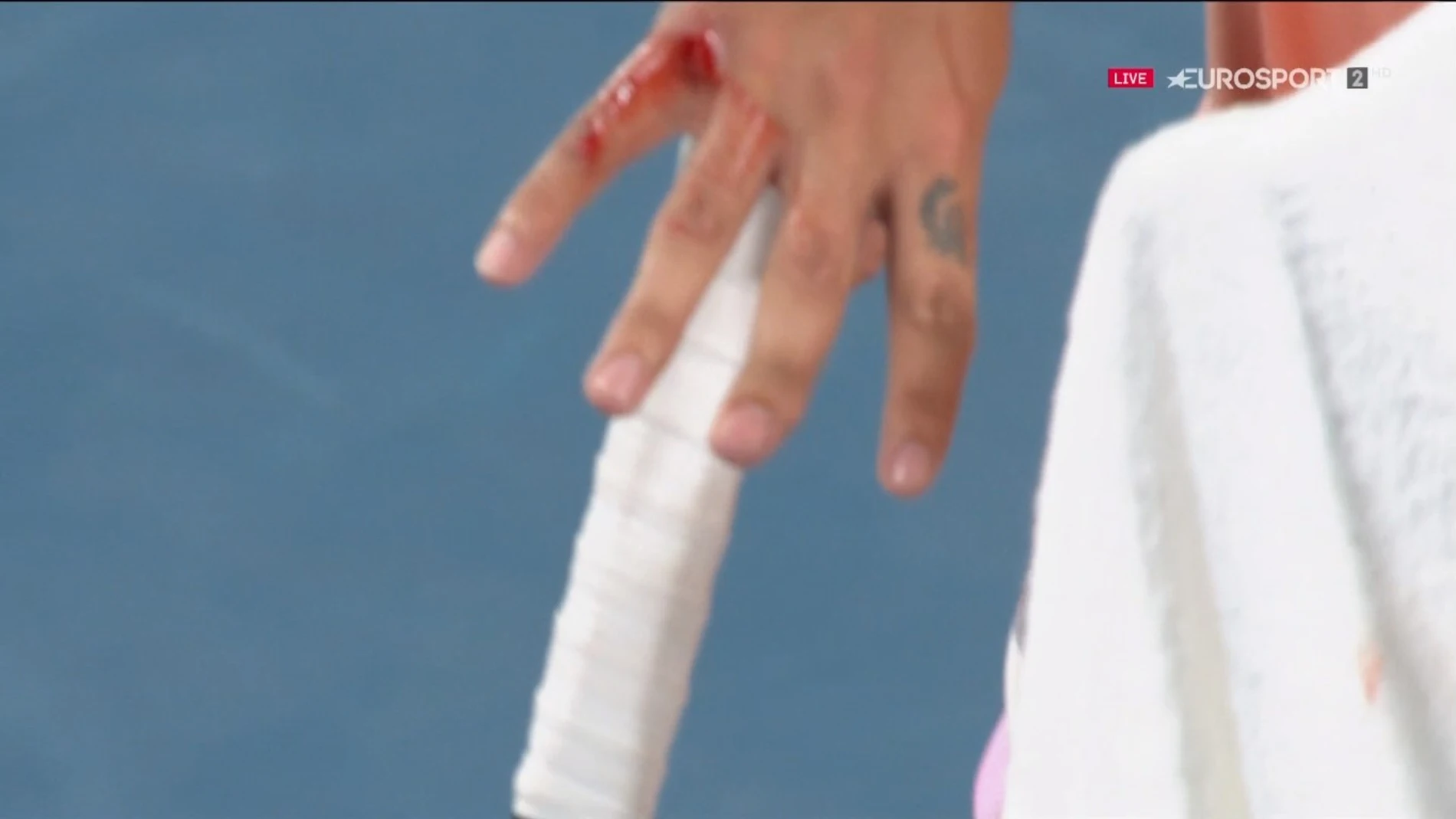 Nick Kyrgios