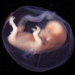 La embriodonación consiste en descongelar embriones que proceden de otras parejas que los han donado con fines reproductivos. Posteriormente, se transfieren al útero de la mujer receptora.