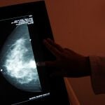Se recomiendan las mamografías preventivas