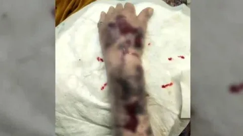 Así quedó el brazo tras la agresión