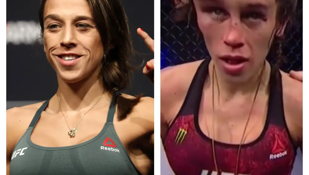 Así quedo el rostro de la luchadora Joanna Jedrzejczyk después del combate de UFC