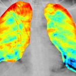 La inteligencia artificial de la española Quibim se nutre de imágenes médicas para objetivizarlas. / Innovadores