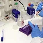  ¿Cómo se detecta el coronavirus en las pruebas?