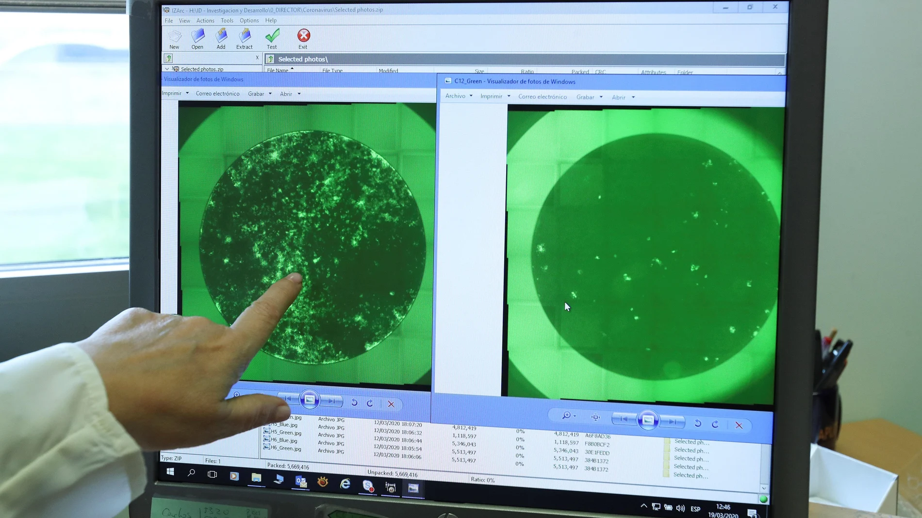 Una trabajadora de la empresa PharmaMar muestra las fotografías de una célula infectada con el Covid-19 y la misma célula tras ser tratada con Plitidepsina, en la que se puede apreciar la considerable disminución de las colonias de coronavirus.