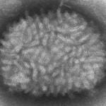 Imagen al microscopio del virus VacciniaCDC/CYNTHIA GOLDSMITH (Foto de ARCHIVO)01/01/1970