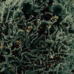 Micrografía electrónica de barrido coloreada de una célula apoptótica, en verde, infectada con partículas del virus SARS-COV-2, en color naranja, aislada de una muestra de paciente