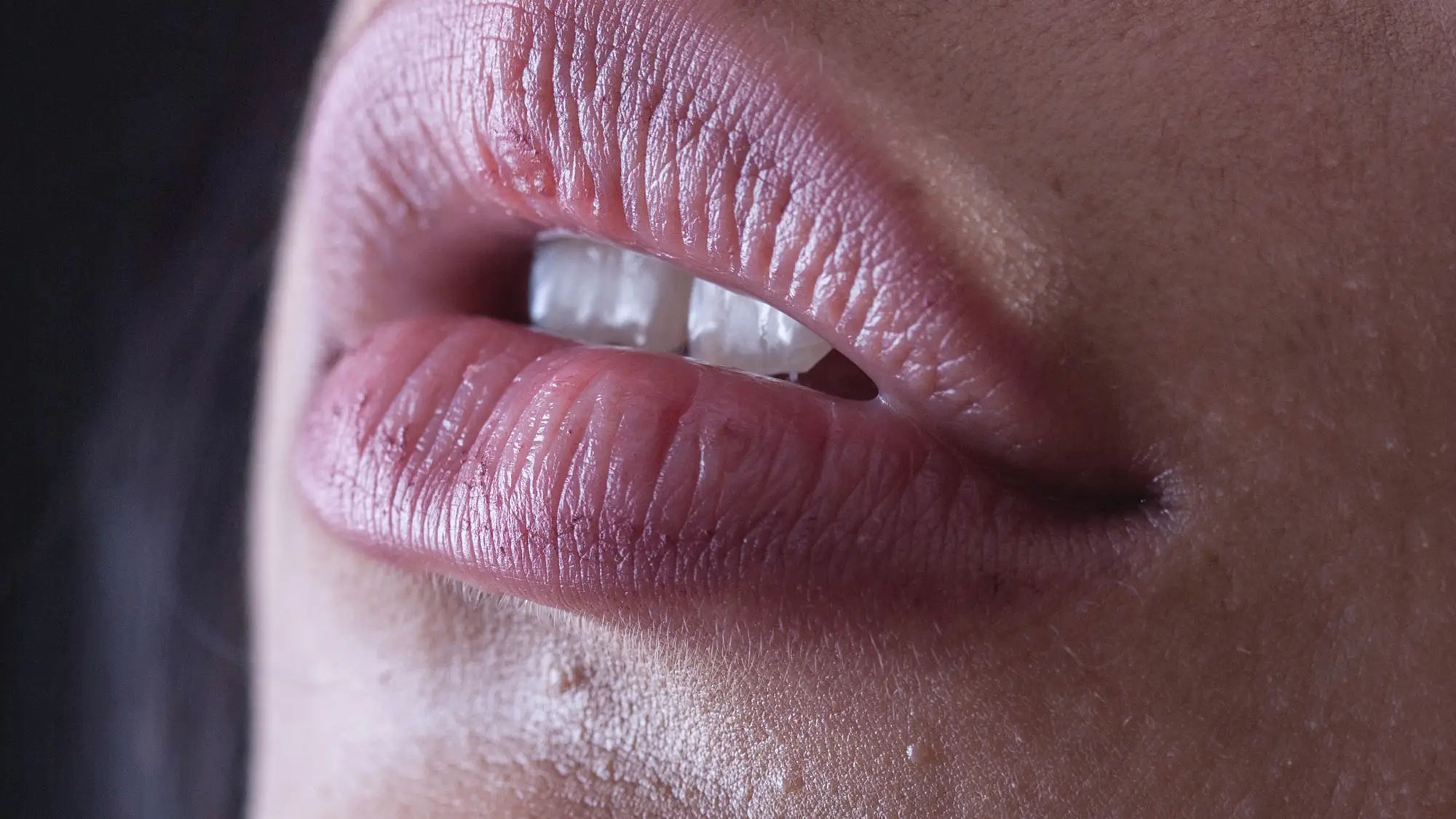 Labios hidratados