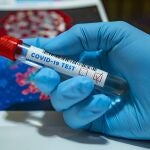 La Comunitat Valenciana está a la cola en la realización de test