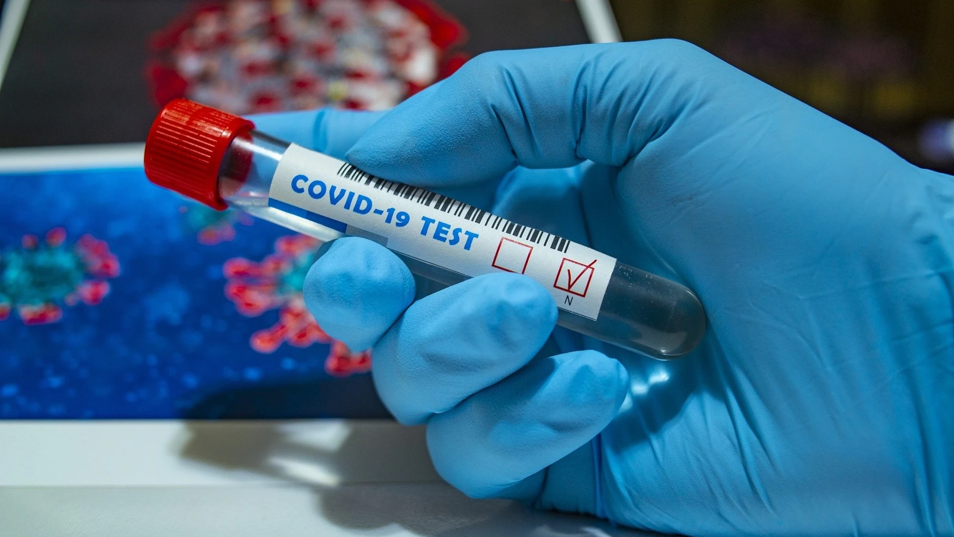Coronavirus.- Los Colegios de Médicos y Enfermería de Ciudad Real entregan 1.700 test PCR al Sescam
