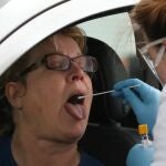 "Es imperativo que los test diagnósticos sean accesibles a toda persona con síntomas", dice el manifiesto