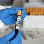 Una sanitario con una muestra de sangre