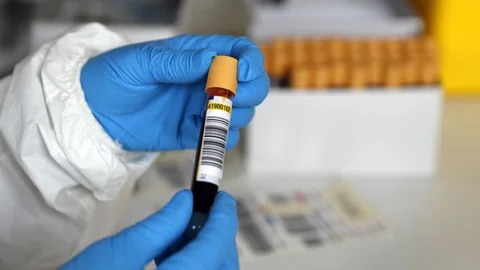 Una sanitario con una muestra de sangre