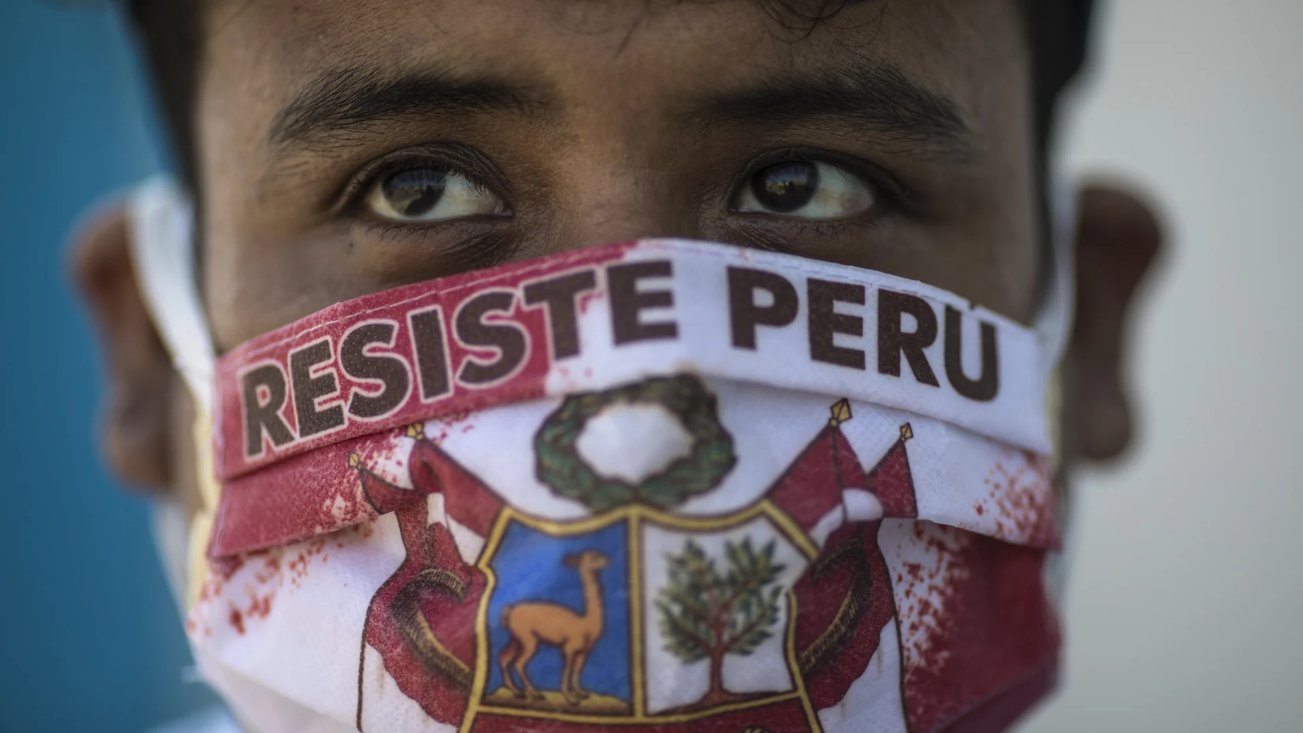 John Sanches wears a face mask with the Spanish message "Resist Peru" as he waits in line to be tested for COVID-19 at Almenara Hospital in Lima, Peru, Friday, April 24, 2020. (AP Photo/Rodrigo Abd)