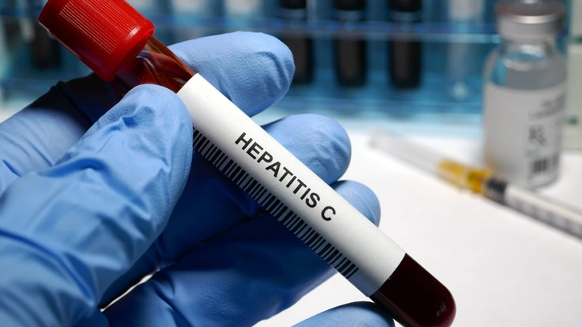 Expertos recomiendan aprovechar la prueba de COVID 19 para realizar la de la hepatitis C