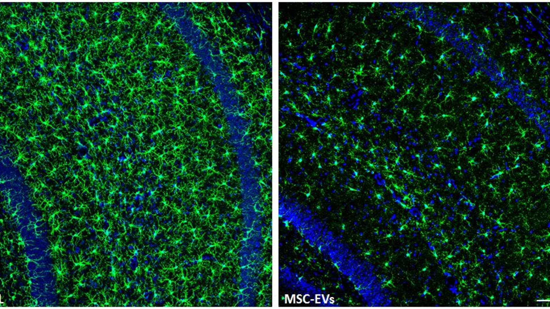 Región del hipocampo de ratones tratados con MSC-EV