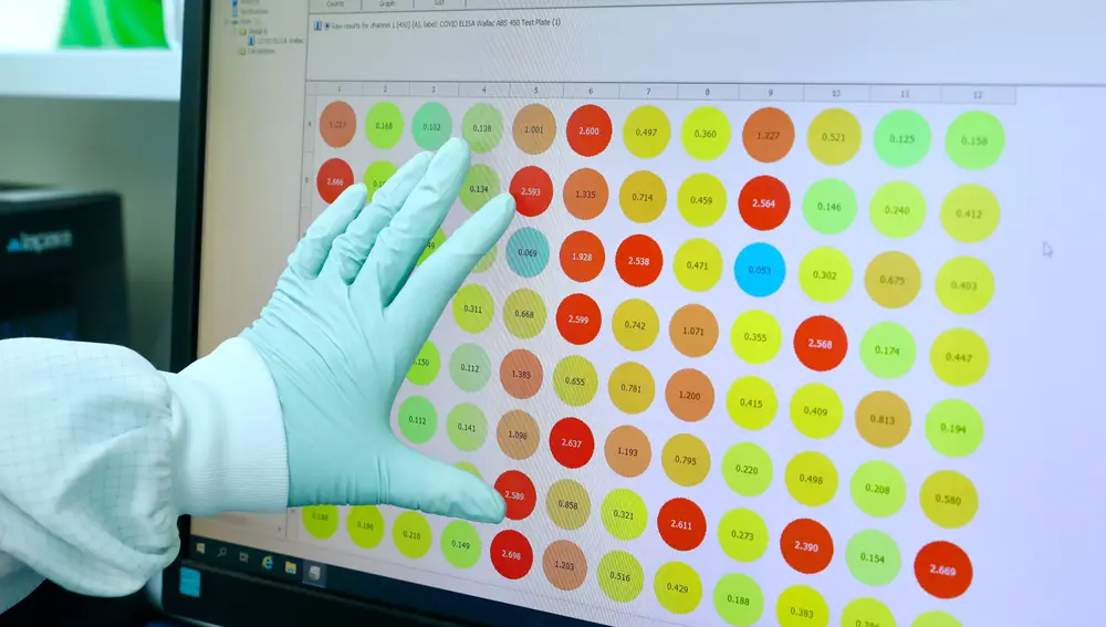 Estudio de los resultados en el laboratorio