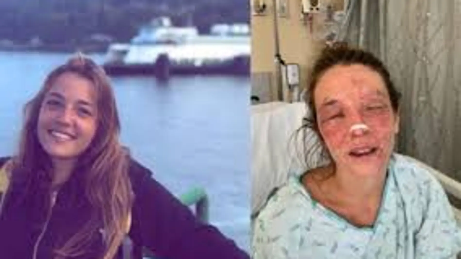 Marta, antes y después del fatal accidente