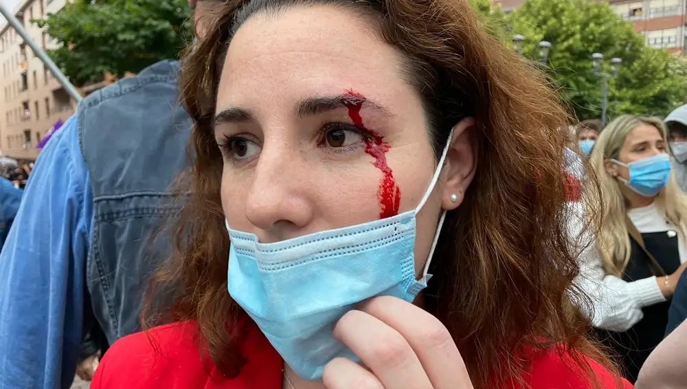 La diputada de Vox Rocío de Meer ha resultado herida al recibir una pedrada antes del mitin del partido en Sestao (Vizcaya)VOX26/06/2020