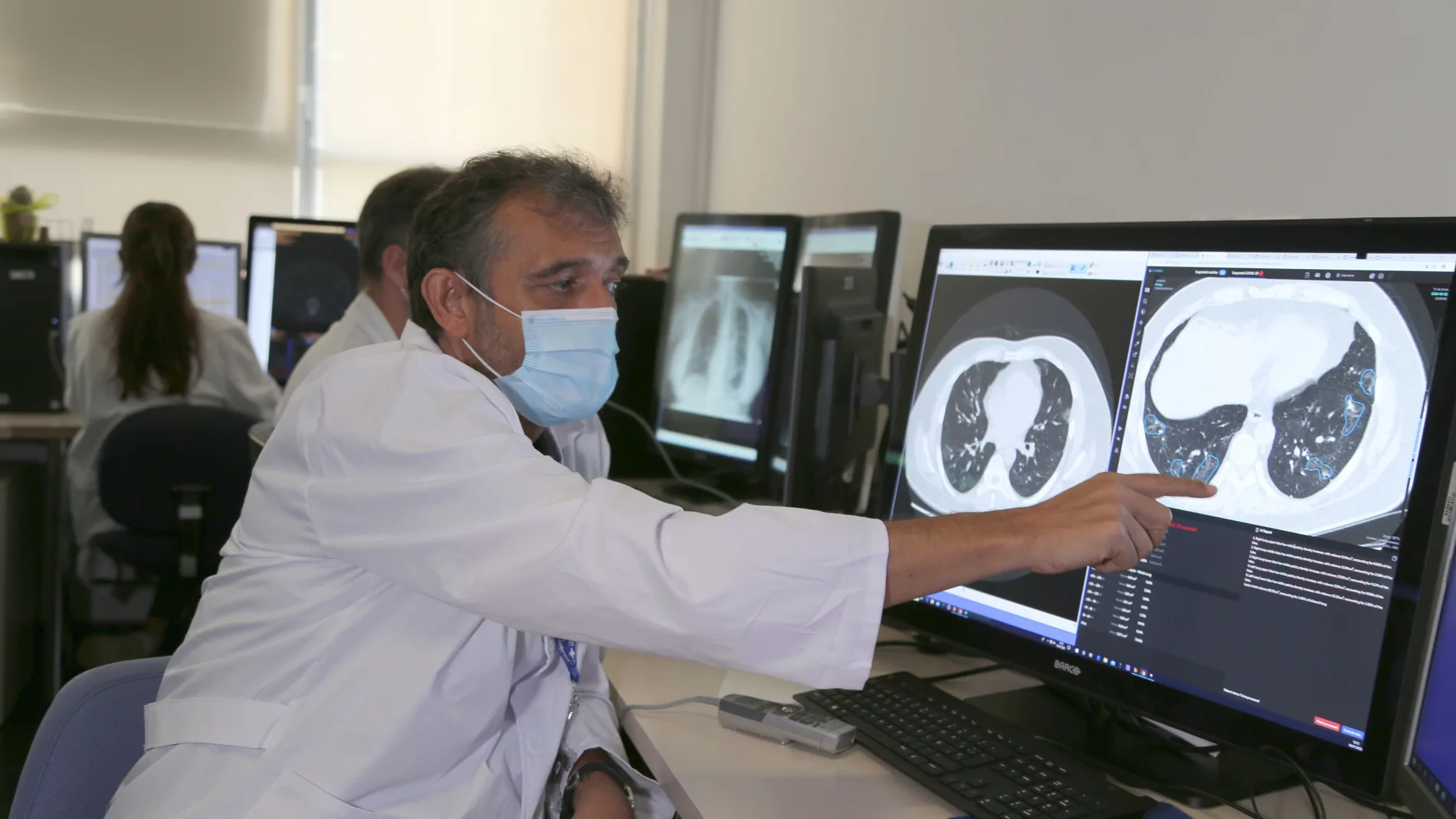 El doctor Daniel Escobar muestra una radiografía de pulmón