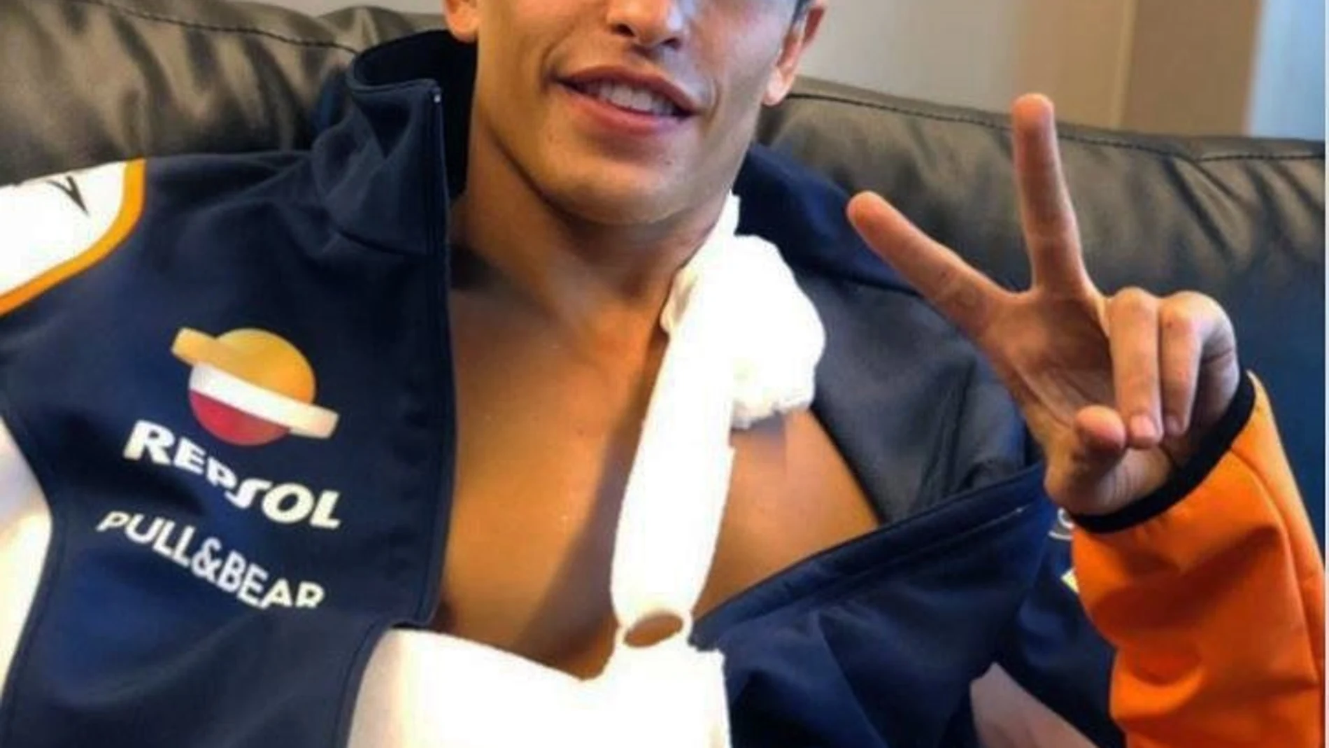 Marc Márquez sufre la fractura completa del tercio medio del húmero del brazo derecho con leve desplazamiento
