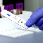 Los test de anticuerpos miden bien la inmunoglobulina IgM o bien la IgG