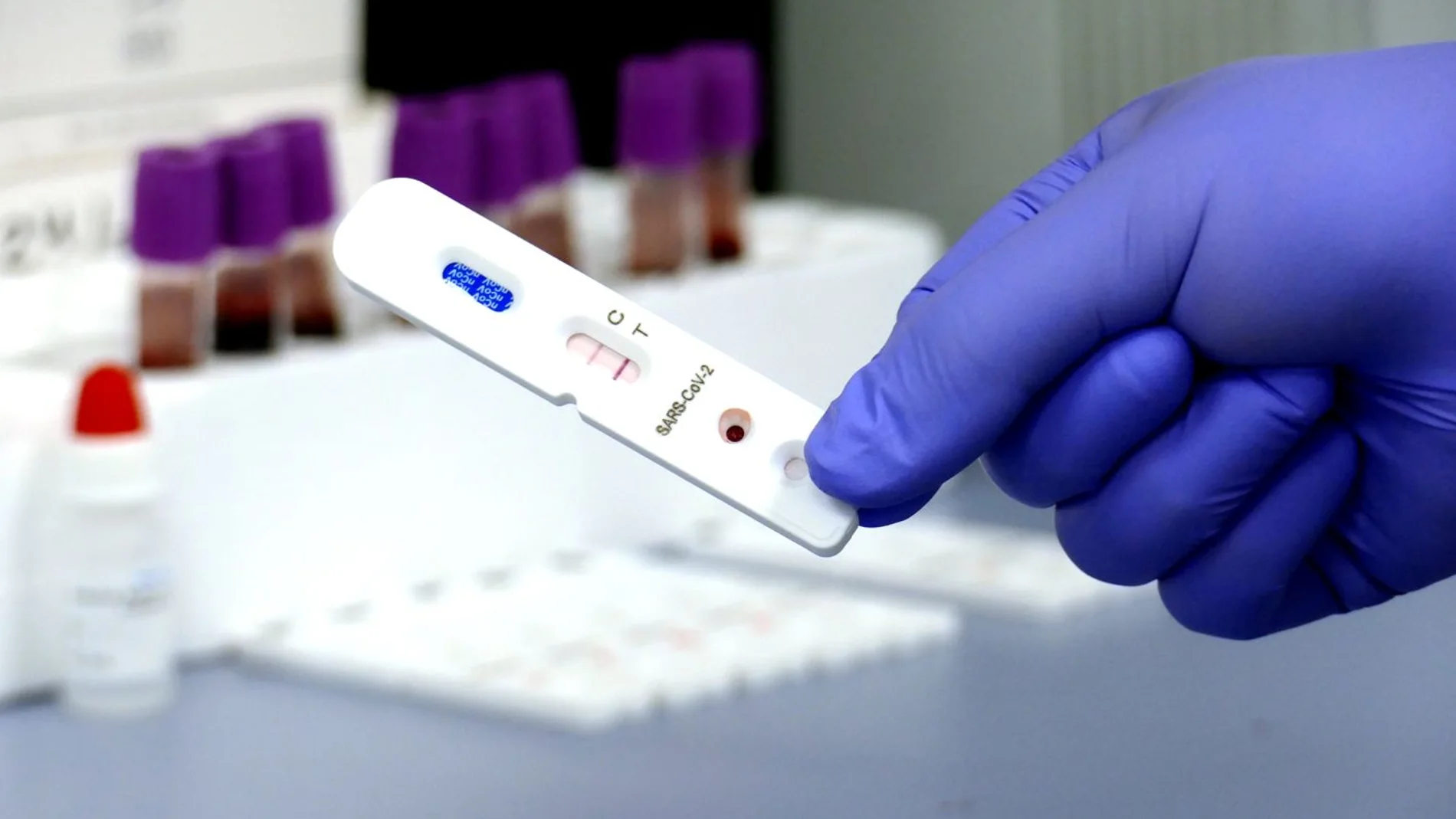Los test de anticuerpos miden bien la inmunoglobulina IgM o bien la IgG