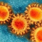 Foto de microscopio electrónico del coronavirus Covid-19