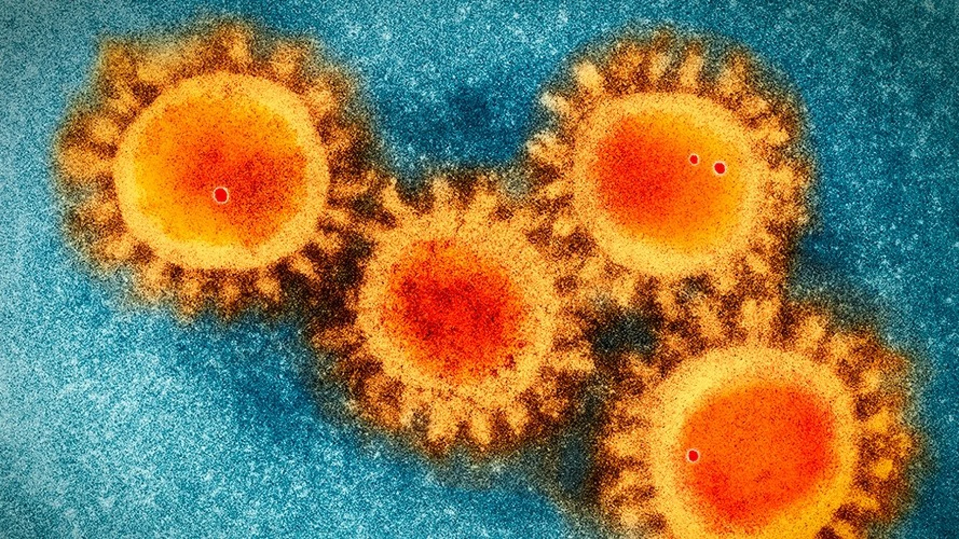 Foto de microscopio electrónico del coronavirus Covid-19