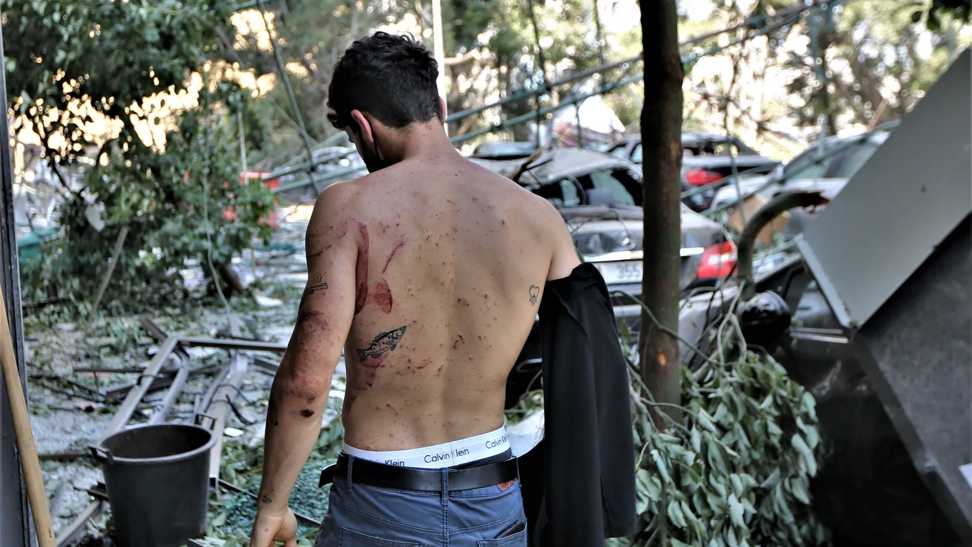 Un vecino de Beirut muestra sus heridas en la espalda provocadas por la explosión