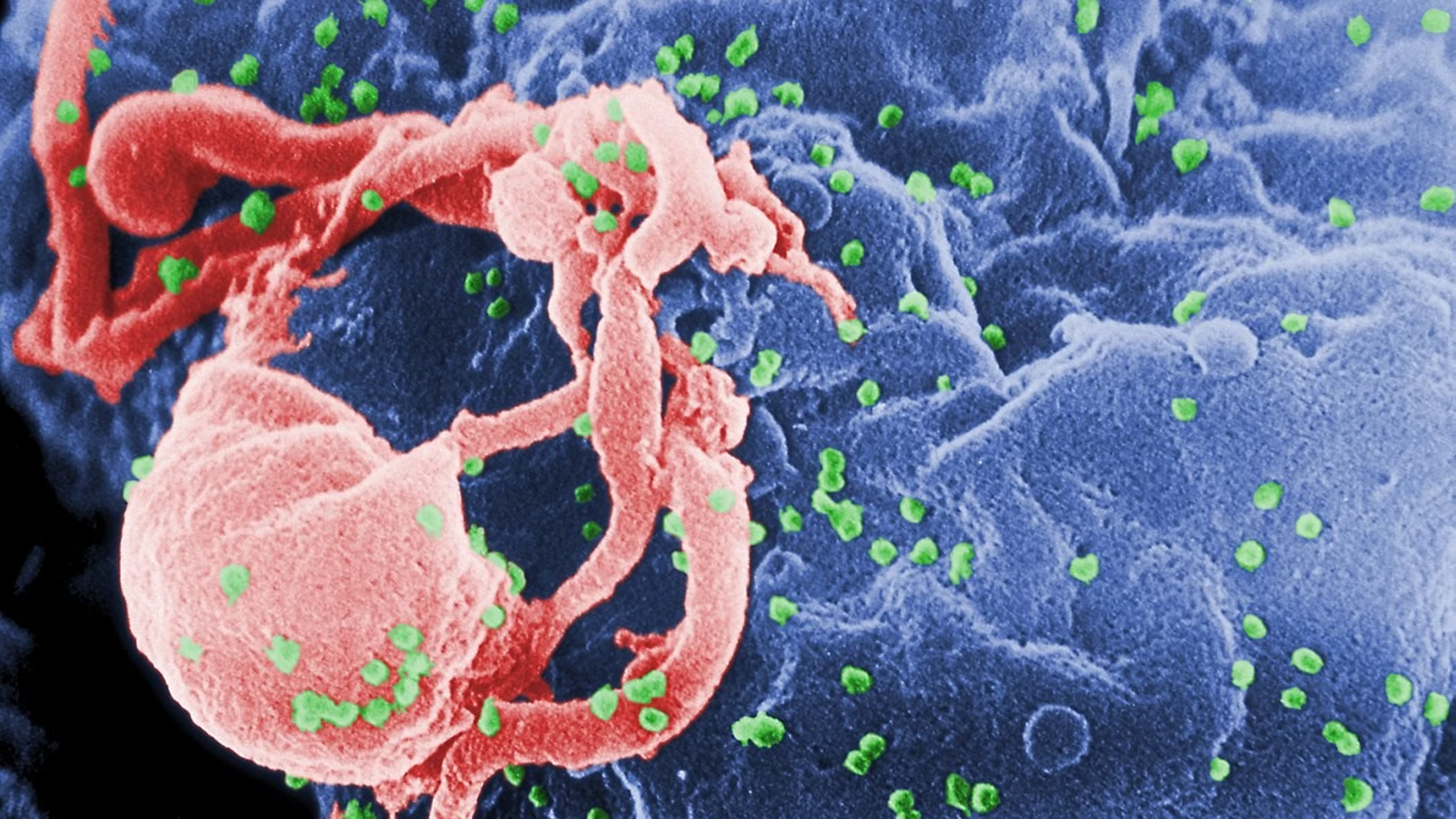 Imágenes de un microoscopio electrónico de la médula ósea infectada por VIH