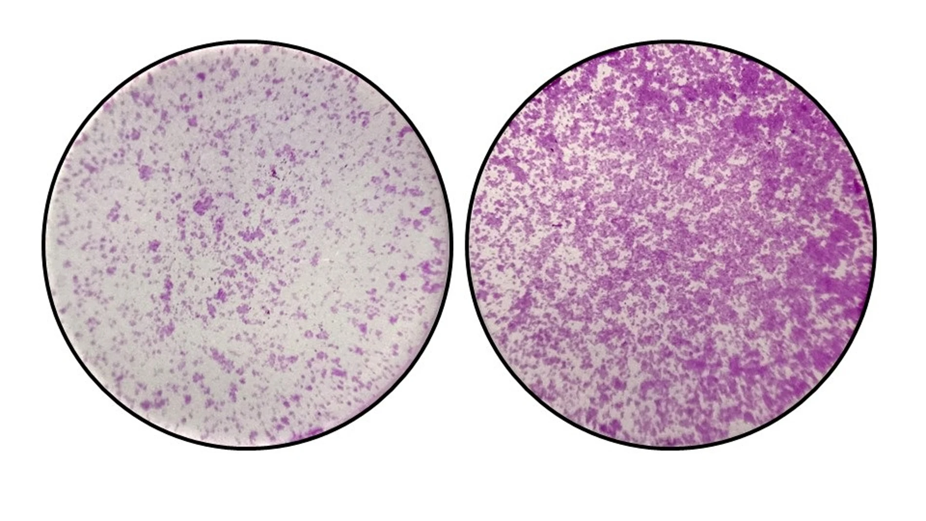 En la izquierda, se observan células del colon con niveles normales de TYW2 y la pieza “Y”. En la derecha, cuando sucede la perdida de TYW2 y el nucleótido “Y”, las células del cáncer de colon empiezan a migrar de forma descontrolada