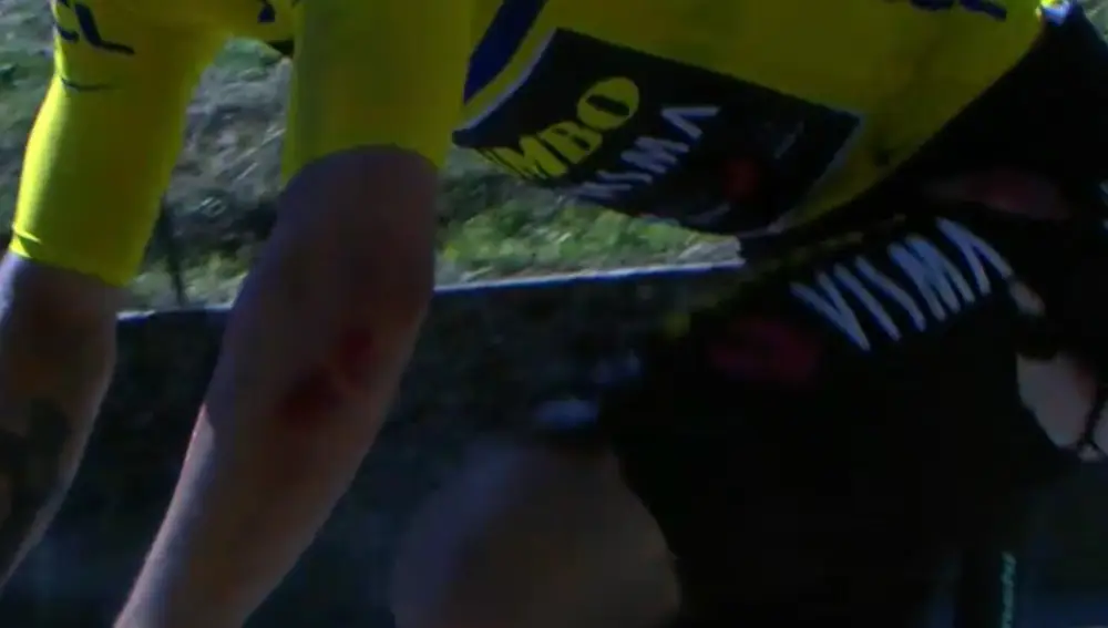 Captura de Eurosport en la que se ven las heridas de Roglic tras su caída