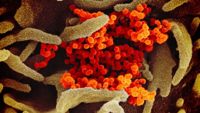 Imágenes de múltiples coronavirus pintados en naranja sobre células en las que han sido cultivados (en verde) tomadas con un microscopio electrónico de barrido.