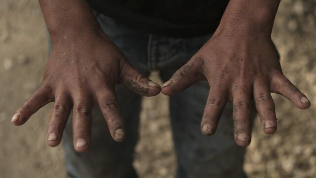 Juan, age 11, whose family did not want to give a last name, shows his hands as he works in his family's coffee fields in the Aldama district of Chiapas State, Mexico, Monday, Aug. 24, 2020. As students across Mexico restarted online and TV classes Monday amid the ongoing coronavirus pandemic, many children in remote rural areas without access to television or internet service were left out, with no way to restart their education. (AP Photo/Isabel Mateos)