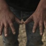 Juan, age 11, whose family did not want to give a last name, shows his hands as he works in his family's coffee fields in the Aldama district of Chiapas State, Mexico, Monday, Aug. 24, 2020. As students across Mexico restarted online and TV classes Monday amid the ongoing coronavirus pandemic, many children in remote rural areas without access to television or internet service were left out, with no way to restart their education. (AP Photo/Isabel Mateos)