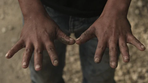 Juan, age 11, whose family did not want to give a last name, shows his hands as he works in his family's coffee fields in the Aldama district of Chiapas State, Mexico, Monday, Aug. 24, 2020. As students across Mexico restarted online and TV classes Monday amid the ongoing coronavirus pandemic, many children in remote rural areas without access to television or internet service were left out, with no way to restart their education. (AP Photo/Isabel Mateos)