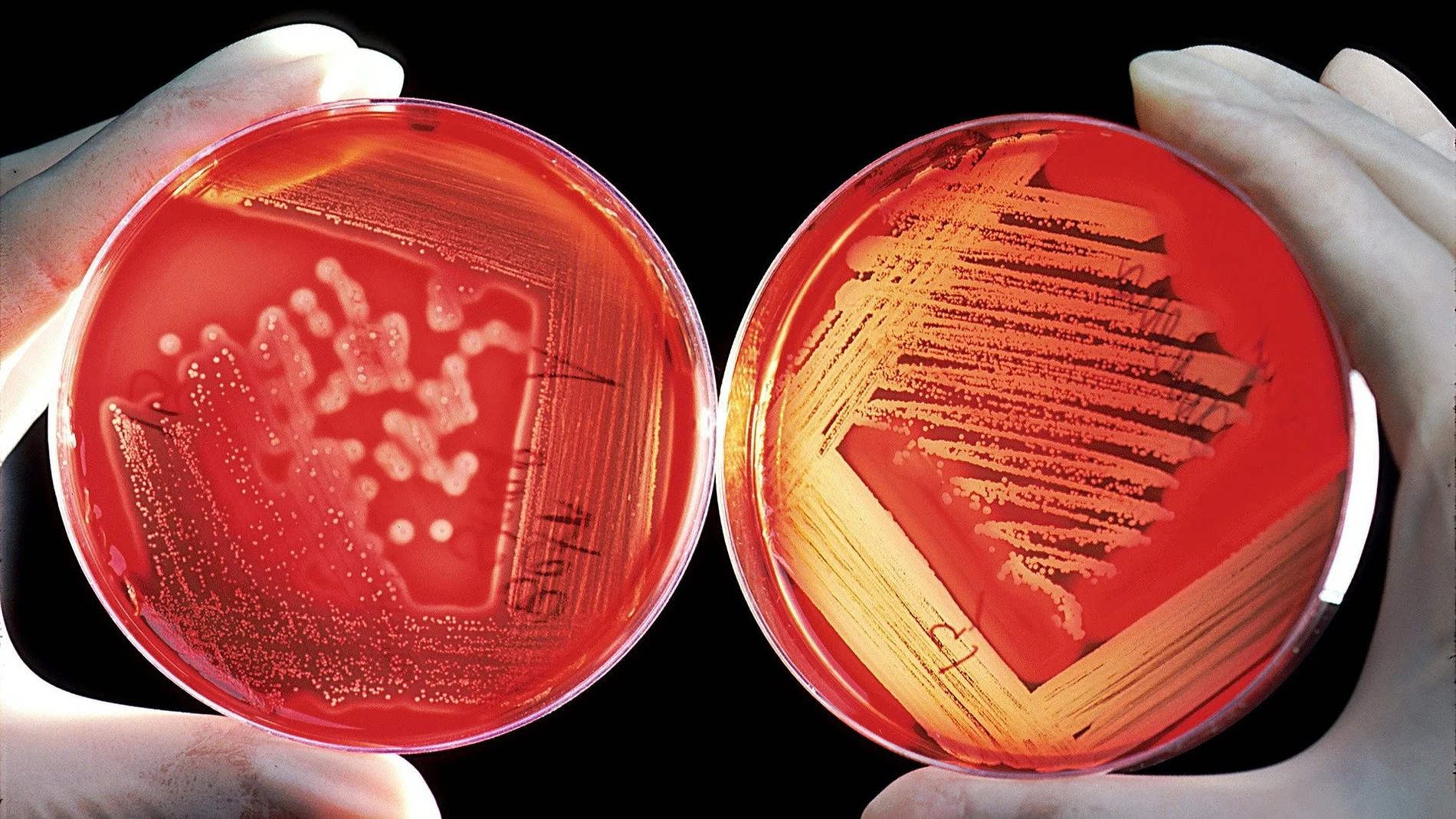 Propuestas para vencer la resistencia bacteriana a los antimicrobianos