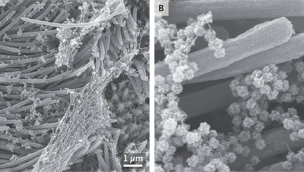 Imagen que muestra los viriones sobre los cilios