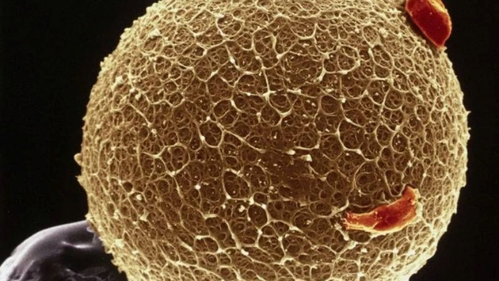 Imagen de un óvulo tomada con micrografía electrónica de barrido