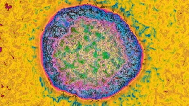 Imagen de un virus de la hepatitis C tomado bajo un microscopio electrónico y con el color editado. (Autoría de Cavallini James)