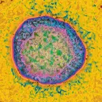 Imagen de un virus de la hepatitis C tomado bajo un microscopio electrónico y con el color editado. (Autoría de Cavallini James)