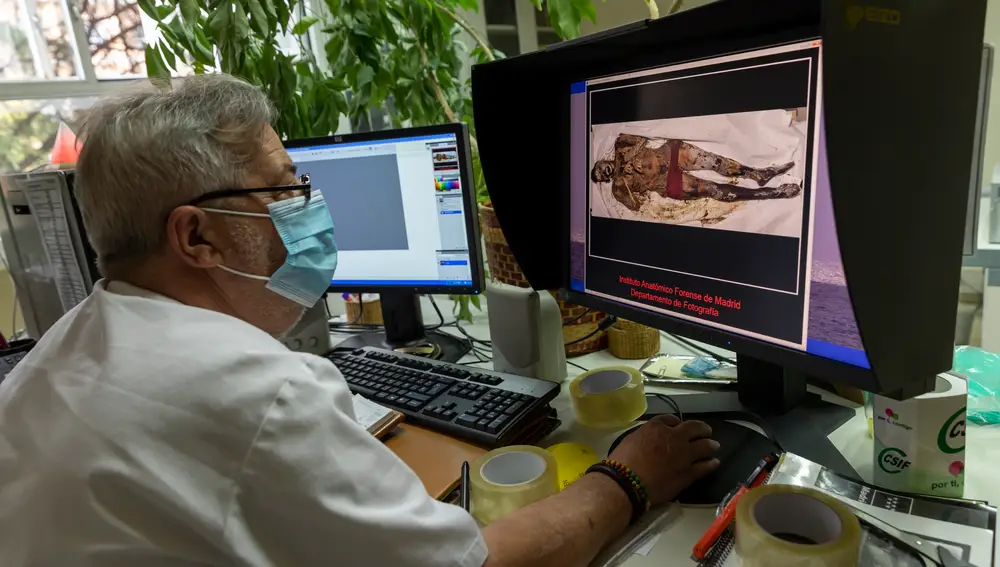 Antonio Ramírez, especialista en fotografía científica, lleva en el Anatómico desde el año 89. Tiene un archivo con todos los cadáveres