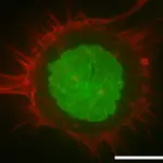 Imagen de una célula humana obtenida mediante microscopía de fluorescencia. Dos proteínas han sido marcadas con sustancias fluorescentes para poder resaltar diferentes partes de la célula. En rojo vemos las fibras de actina, que en este caso están localizadas sobre todo en el córtex celular, con lo que este color nos permite visualizar la “piel” de la célula. En verde se ha marcado una histona, una proteína que forma parte de los cromosomas, así que en este color podemos ver el núcleo de la célula. La imagen es tan precisa que podemos apreciar las “arrugas” características del material nuclear. La barra de escala, en blanco en la parte inferior, mide 10 micras.