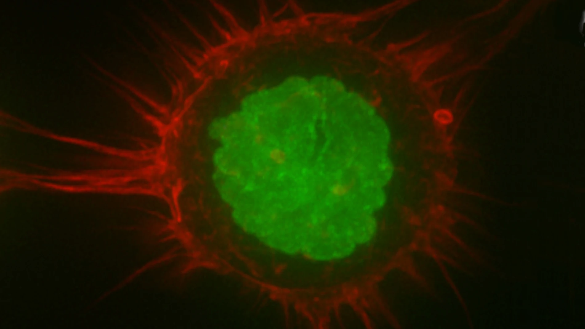 Imagen de una célula humana obtenida mediante microscopía de fluorescencia. Dos proteínas han sido marcadas con sustancias fluorescentes para poder resaltar diferentes partes de la célula. En rojo vemos las fibras de actina, que en este caso están localizadas sobre todo en el córtex celular, con lo que este color nos permite visualizar la “piel” de la célula. En verde se ha marcado una histona, una proteína que forma parte de los cromosomas, así que en este color podemos ver el núcleo de la célula. La imagen es tan precisa que podemos apreciar las “arrugas” características del material nuclear. La barra de escala, en blanco en la parte inferior, mide 10 micras.
