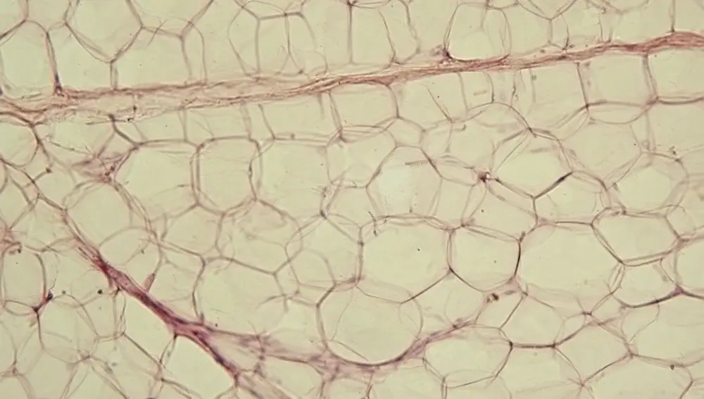 Imagen de un tejido adiposo al microscopio, en la que podemos apreciar cómo cada célula está sometida a presión por parte de las vecinas.