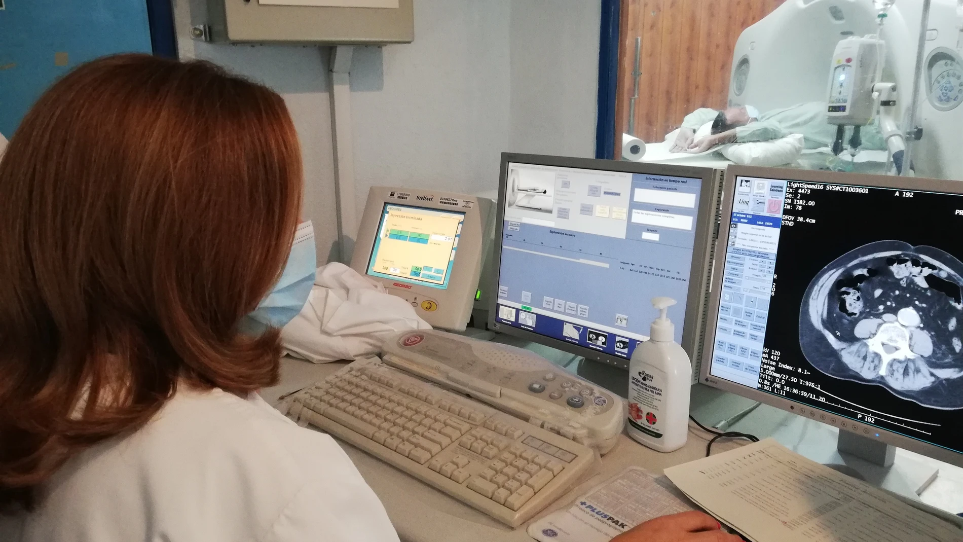 Hospital Universitario Virgen del Rocío ha evaluado el rendimiento de más de 300 TC de tórax prequirúrgicos hechos en el centro para detectar Covid-19
