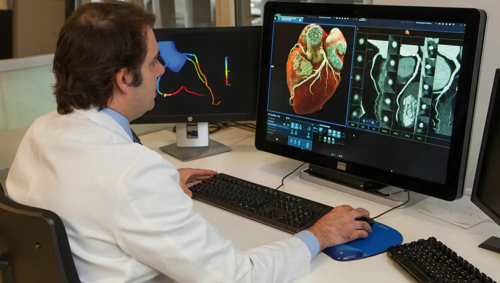 Realización de coronariografía por TAC para la valoración de arterias coronarias